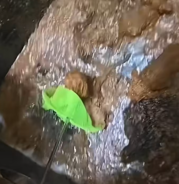 T0101028 Sometimes rescue starts with one pause.