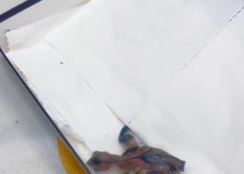 T2801028,This baby bird survived only because someone noticed in time 💔 #animalrescue #hope